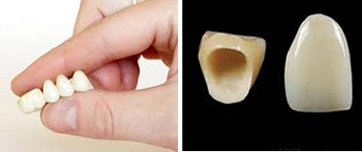 ZIRCONIUM BASED CROWNS