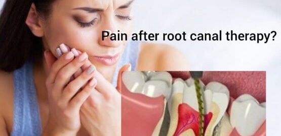pain after root canal